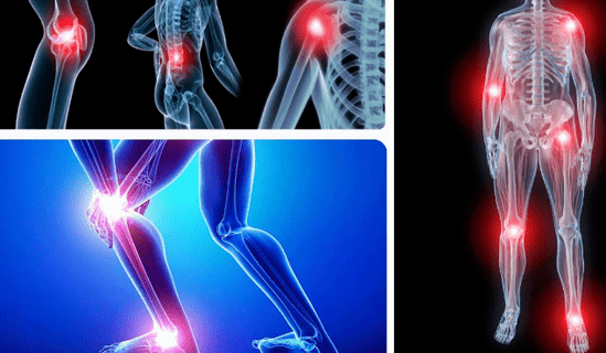 Viêm Khớp: Nguyên Nhân, Triệu Chứng, Cách Điều Trị